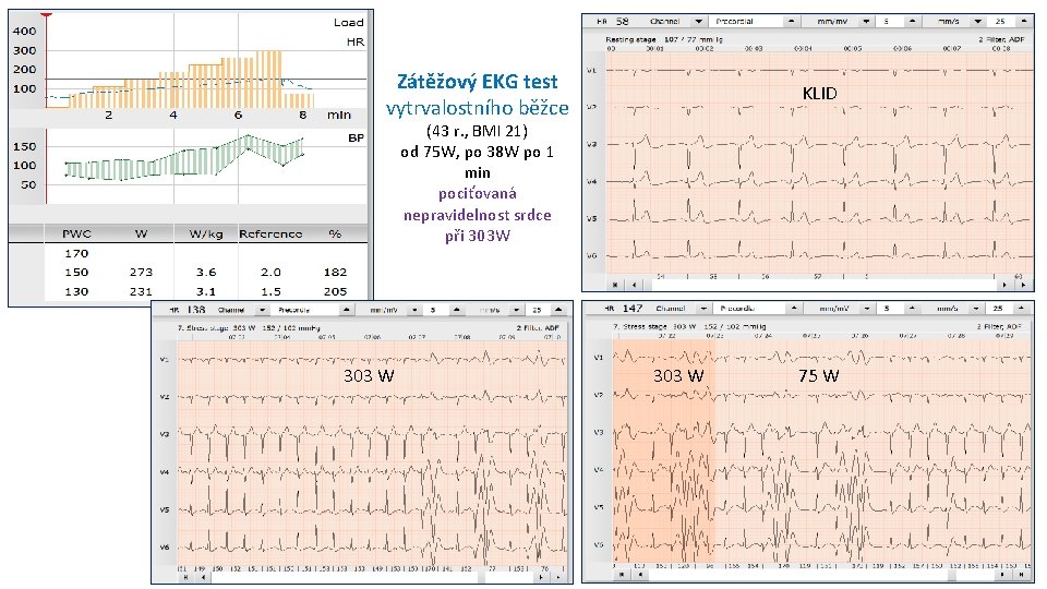 Zátěžový EKG test vytrvalostního běžce KLID (43 r. , BMI 21) od 75 W,