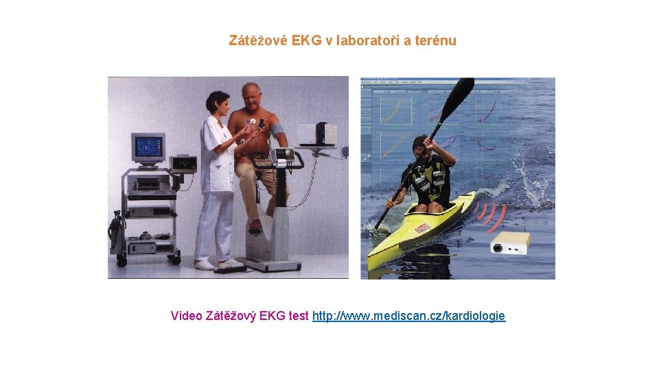 Zátěžové EKG v laboratoři a terénu Video Zátěžový EKG test http: //www. mediscan. cz/kardiologie