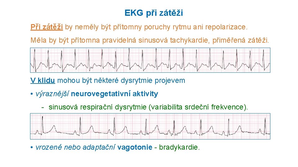EKG při zátěži Při zátěži by neměly být přítomny poruchy rytmu ani repolarizace. Měla