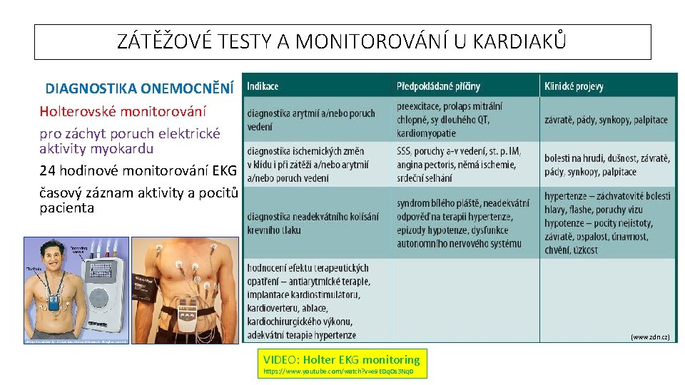 ZÁTĚŽOVÉ TESTY A MONITOROVÁNÍ U KARDIAKŮ DIAGNOSTIKA ONEMOCNĚNÍ Holterovské monitorování pro záchyt poruch elektrické