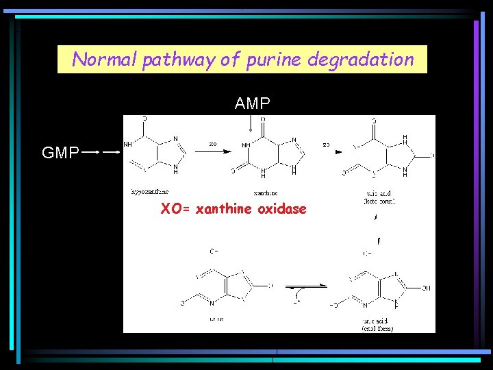 Normal pathway of purine degradation AMP GMP XO= xanthine oxidase 