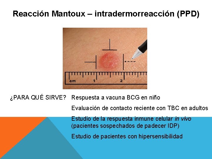 Reacción Mantoux – intradermorreacción (PPD) ¿PARA QUÉ SIRVE? Respuesta a vacuna BCG en niño