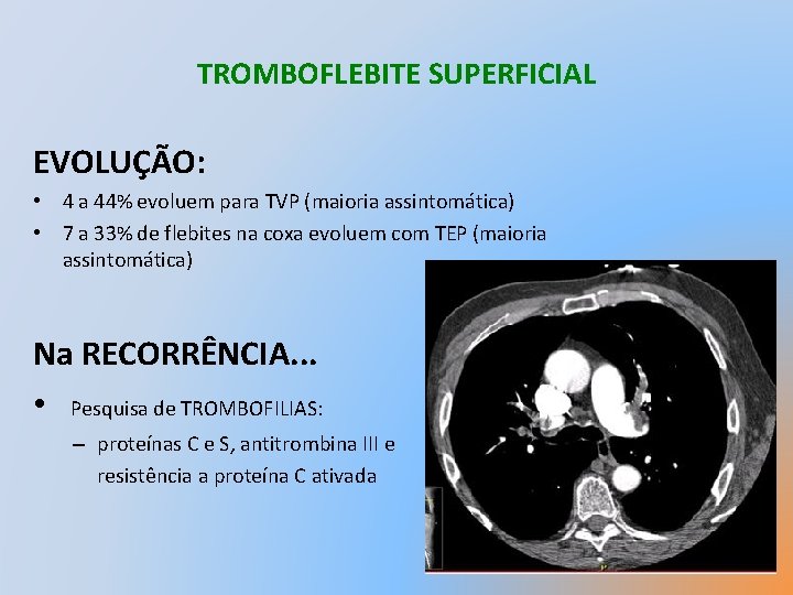 TROMBOFLEBITE SUPERFICIAL EVOLUÇÃO: • 4 a 44% evoluem para TVP (maioria assintomática) • 7