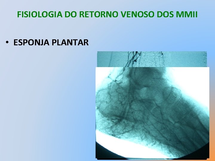 FISIOLOGIA DO RETORNO VENOSO DOS MMII • ESPONJA PLANTAR 