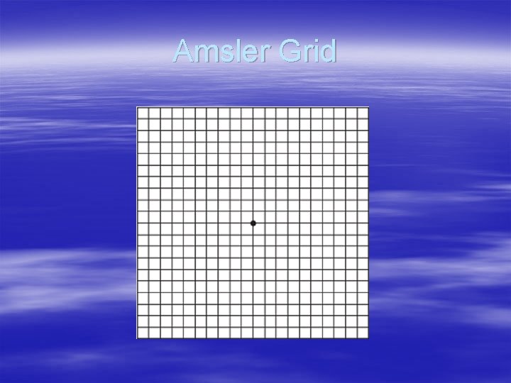 Amsler Grid 