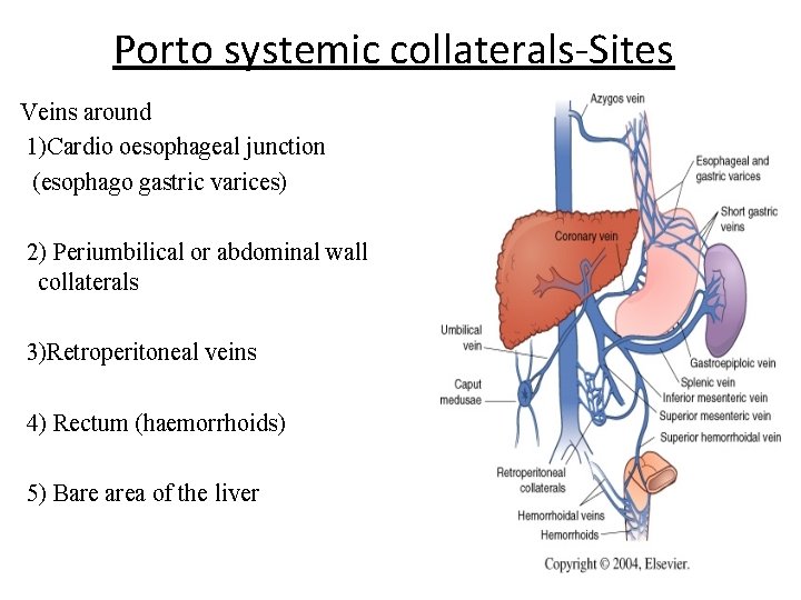 Porto systemic collaterals-Sites Veins around 1)Cardio oesophageal junction (esophago gastric varices) 2) Periumbilical or