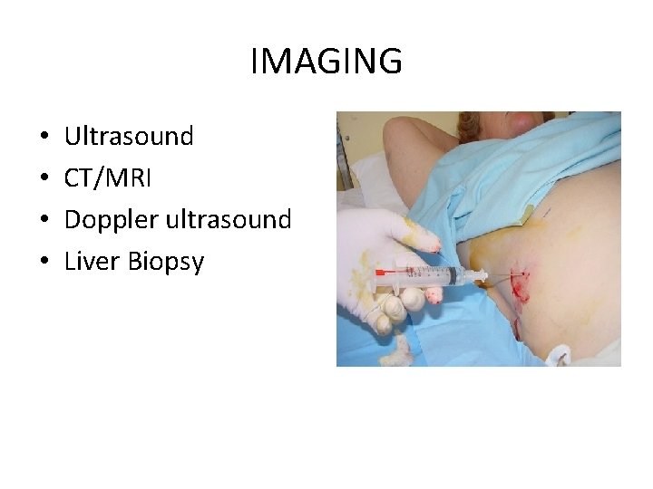 IMAGING • • Ultrasound CT/MRI Doppler ultrasound Liver Biopsy 