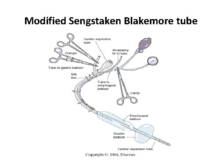 Modified Sengstaken Blakemore tube 