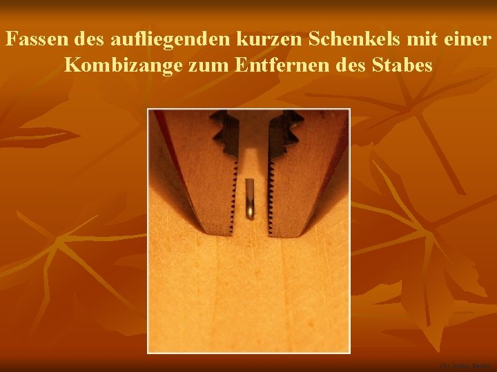 Fassen des aufliegenden kurzen Schenkels mit einer Kombizange zum Entfernen des Stabes (Dr. Heine,