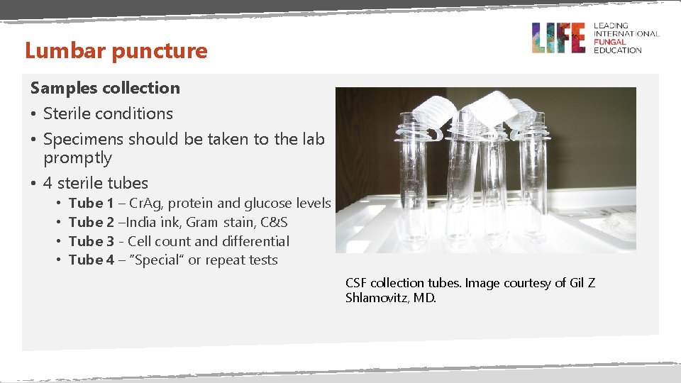 Lumbar puncture Samples collection • Sterile conditions • Specimens should be taken to the