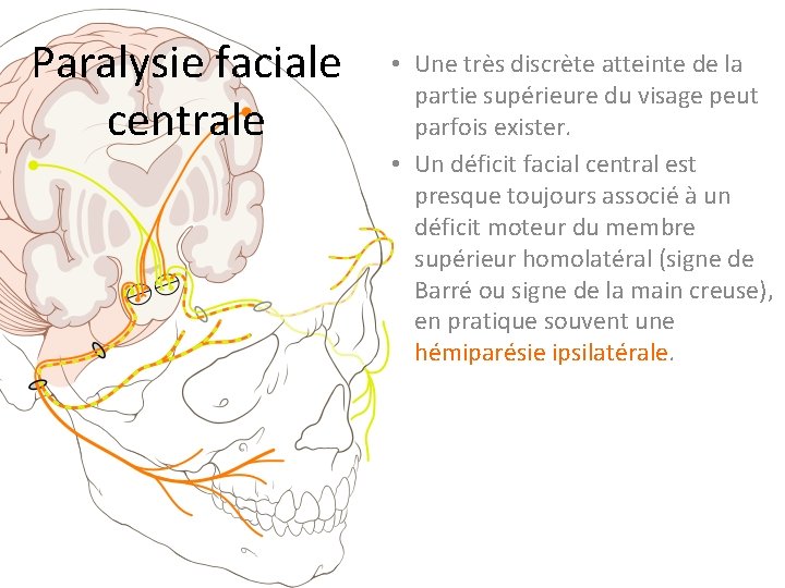 Paralysie faciale centrale • Une très discrète atteinte de la partie supérieure du visage