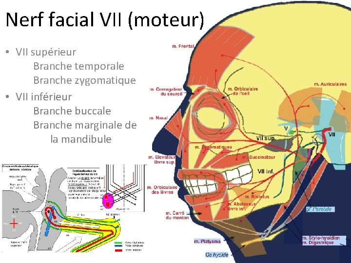 Nerf facial VII (moteur) • VII supérieur Branche temporale Branche zygomatique • VII inférieur