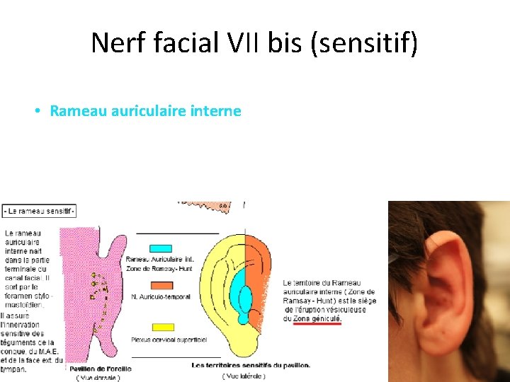 Nerf facial VII bis (sensitif) • Rameau auriculaire interne 