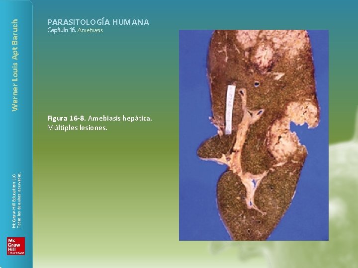 Werner Louis Apt Baruch PARASITOLOGÍA HUMANA Capítulo 16. Amebiasis Todos los derechos reservados. Mc.