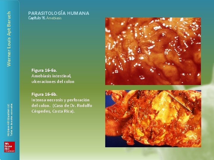 Werner Louis Apt Baruch PARASITOLOGÍA HUMANA Capítulo 16. Amebiasis Todos los derechos reservados. Mc.