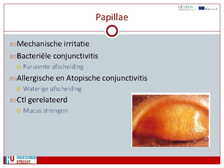 Papillae Mechanische irritatie Bacteriële conjunctivitis Purulente afscheiding Allergische en Atopische conjunctivitis Waterige afscheiding Ctl
