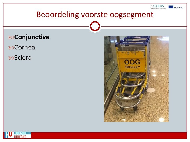 Beoordeling voorste oogsegment Conjunctiva Cornea Sclera 