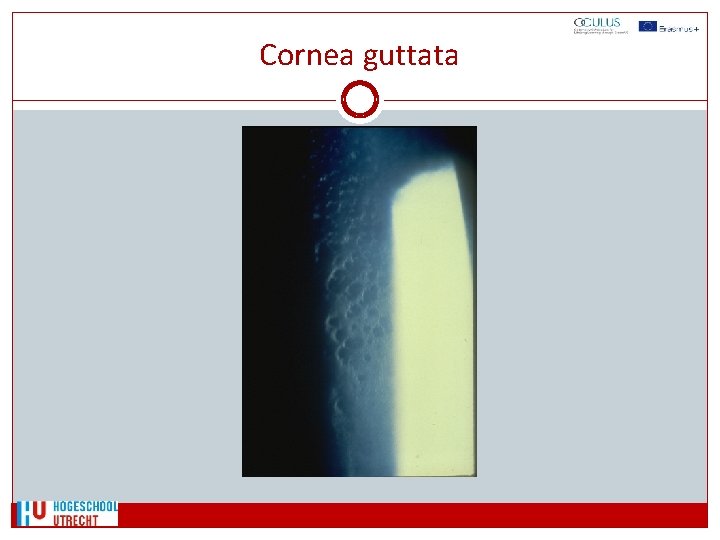 Cornea guttata 