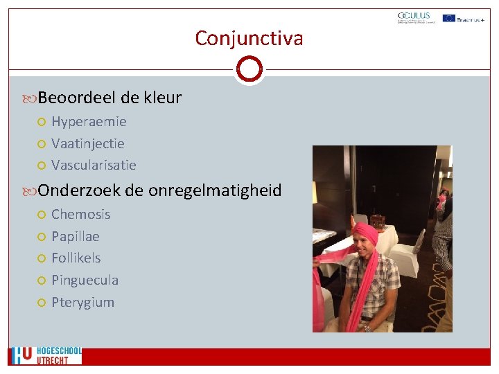 Conjunctiva Beoordeel de kleur Hyperaemie Vaatinjectie Vascularisatie Onderzoek de onregelmatigheid Chemosis Papillae Follikels Pinguecula