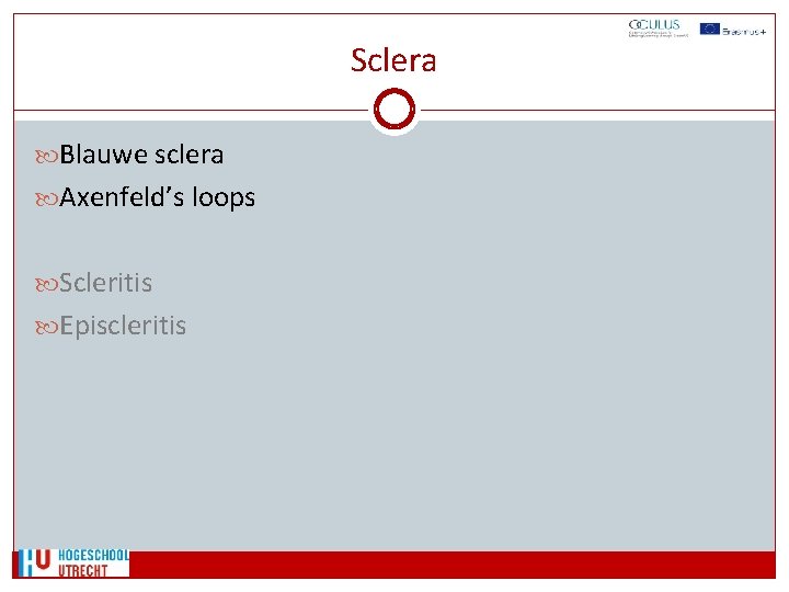 Sclera Blauwe sclera Axenfeld’s loops Scleritis Episcleritis 