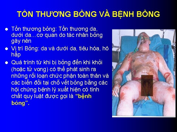TỔN THƯƠNG BỎNG VÀ BỆNH BỎNG Tổn thương bỏng: Tổn thương da, dưới da…cơ