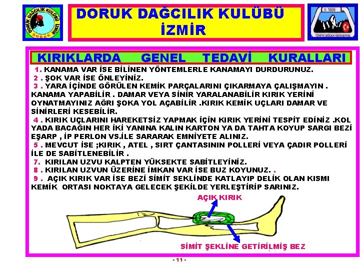 DORUK DAĞCILIK KULÜBÜ İZMİR KIRIKLARDA GENEL TEDAVİ KURALLARI 1. KANAMA VAR İSE BİLİNEN YÖNTEMLERLE