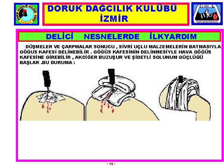 DORUK DAĞCILIK KULÜBÜ İZMİR DELİCİ NESNELERDE İLKYARDIM DÜŞMELER VE ÇARPMALAR SONUCU , SİVRİ UÇLU