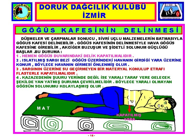 DORUK DAĞCILIK KULÜBÜ İZMİR GÖĞÜS KAFESİNİN DELİNMESİ DÜŞMELER VE ÇARPMALAR SONUCU , SİVRİ UÇLU