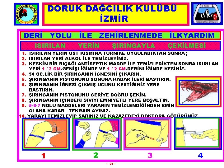 DORUK DAĞCILIK KULÜBÜ İZMİR DERİ YOLU İLE ZEHİRLENMEDE İLKYARDIM. ISIRILAN YERİN ŞIRINGAYLA ÇEKİLMESİ 1.