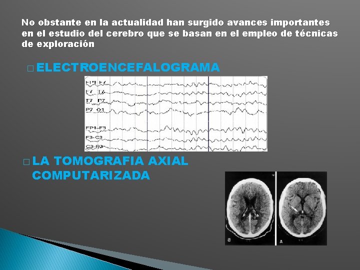 No obstante en la actualidad han surgido avances importantes en el estudio del cerebro