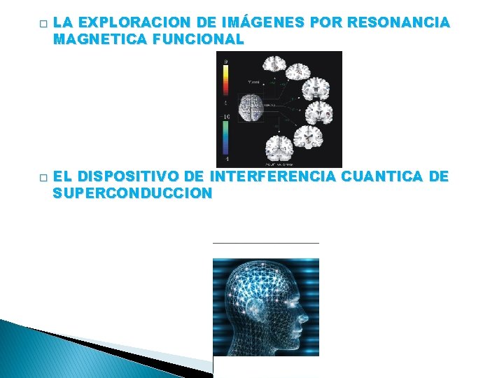 � � LA EXPLORACION DE IMÁGENES POR RESONANCIA MAGNETICA FUNCIONAL EL DISPOSITIVO DE INTERFERENCIA