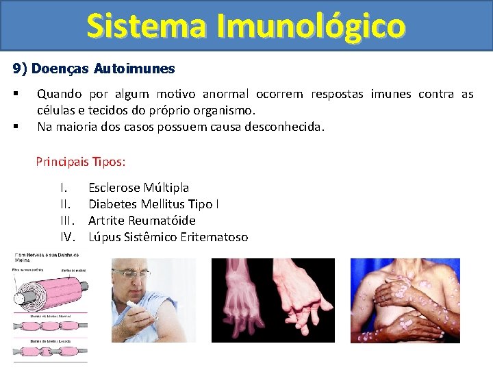 Sistema Imunológico 9) Doenças Autoimunes § § Quando por algum motivo anormal ocorrem respostas