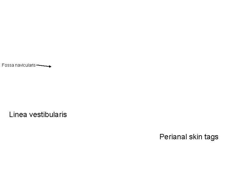 Fossa navicularis Linea vestibularis Perianal skin tags 