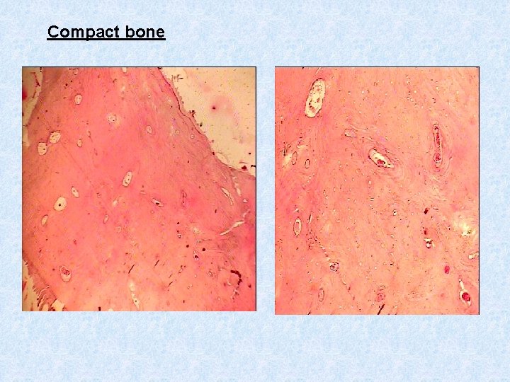 Compact bone 