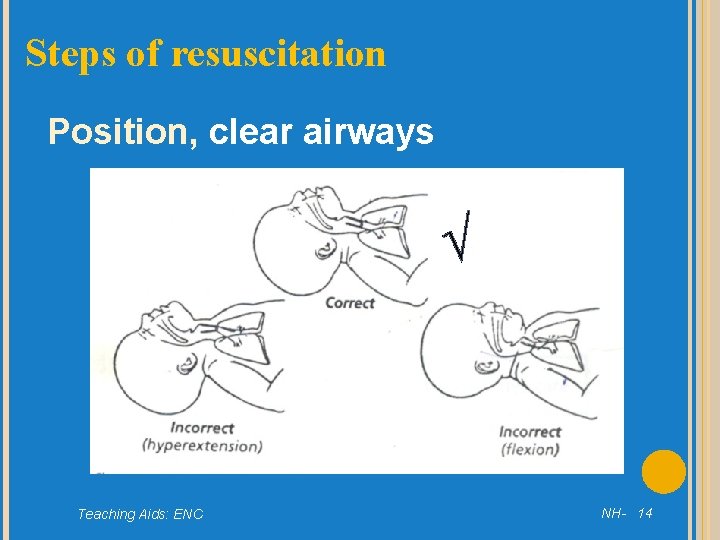 Steps of resuscitation Position, clear airways √ Teaching Aids: ENC NH- 14 