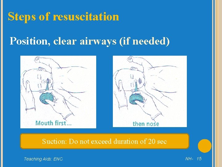 Steps of resuscitation Position, clear airways (if needed) Suction: Do not exceed duration of