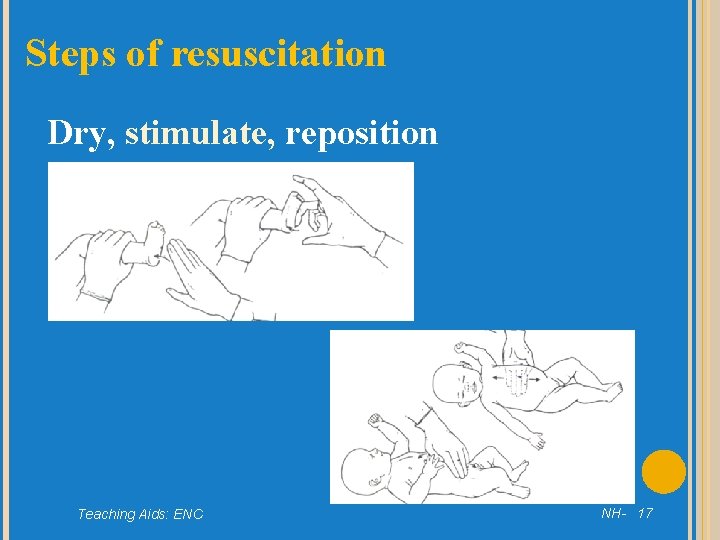 Steps of resuscitation Dry, stimulate, reposition Teaching Aids: ENC NH- 17 