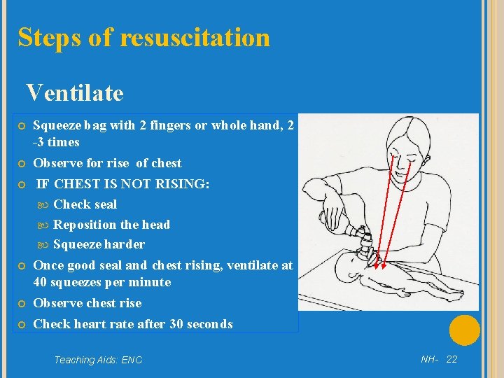 Steps of resuscitation Ventilate Squeeze bag with 2 fingers or whole hand, 2 -3