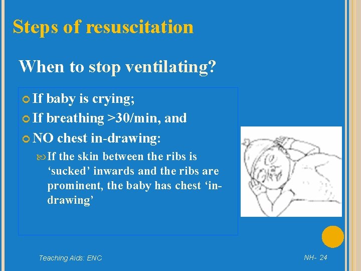 Steps of resuscitation When to stop ventilating? If baby is crying; If breathing >30/min,