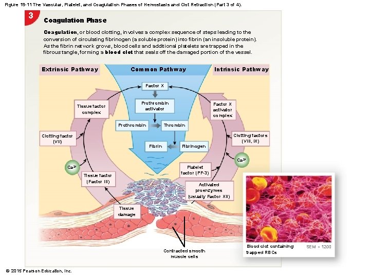 Figure 19 -11 The Vascular, Platelet, and Coagulation Phases of Hemostasis and Clot Retraction