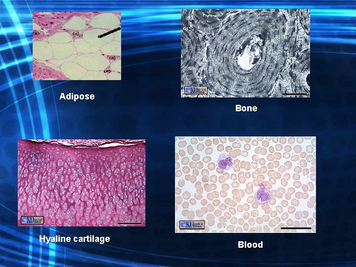Adipose Bone Hyaline cartilage Blood 