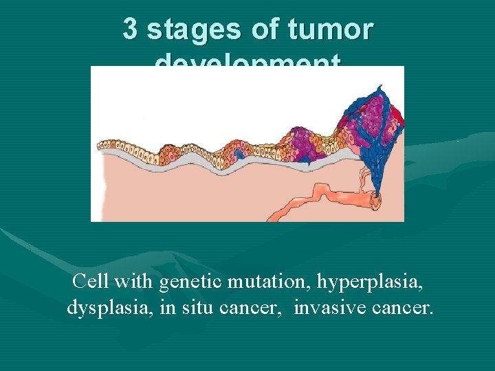 3 stages of tumor development Cell with genetic mutation, hyperplasia, dysplasia, in situ cancer,