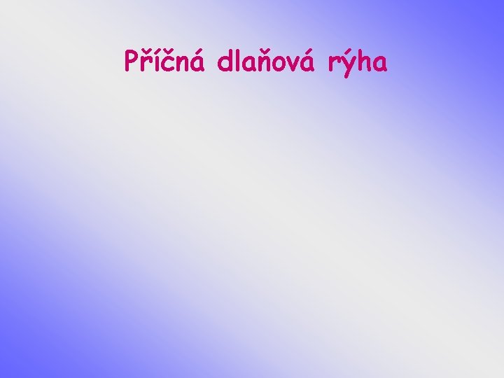 Příčná dlaňová rýha 
