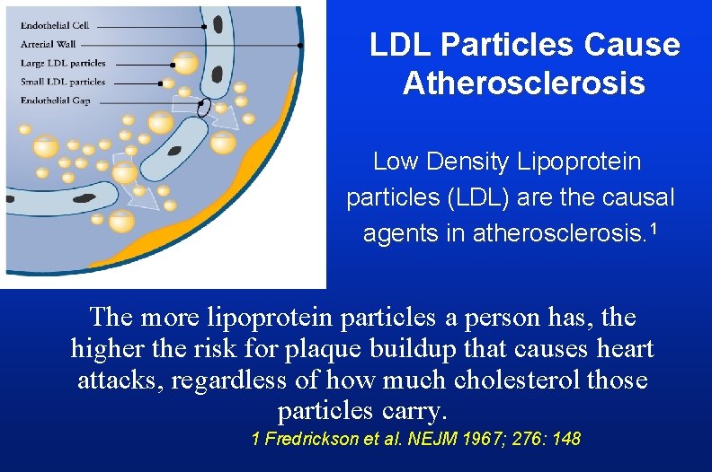 LDL Particles Cause Atherosclerosis Low Density Lipoprotein particles (LDL) are the causal agents in