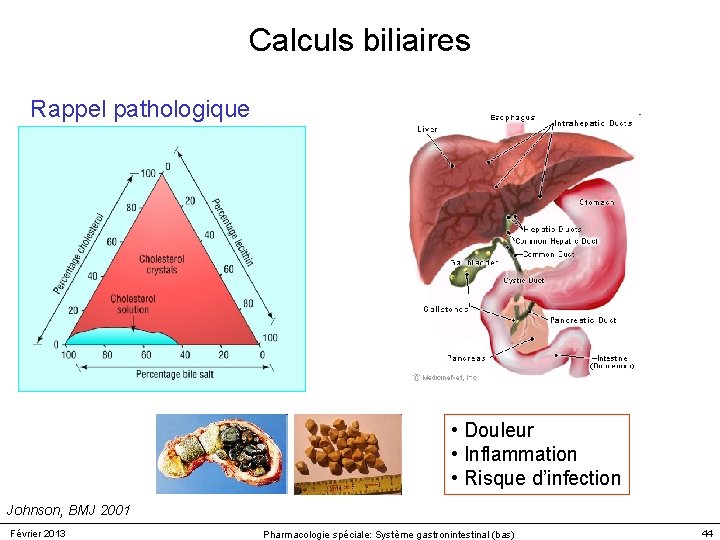 Calculs biliaires Rappel pathologique • Douleur • Inflammation • Risque d’infection Johnson, BMJ 2001 Calculs biliaires Rappel pathologique • Douleur • Inflammation • Risque d’infection Johnson, BMJ 2001