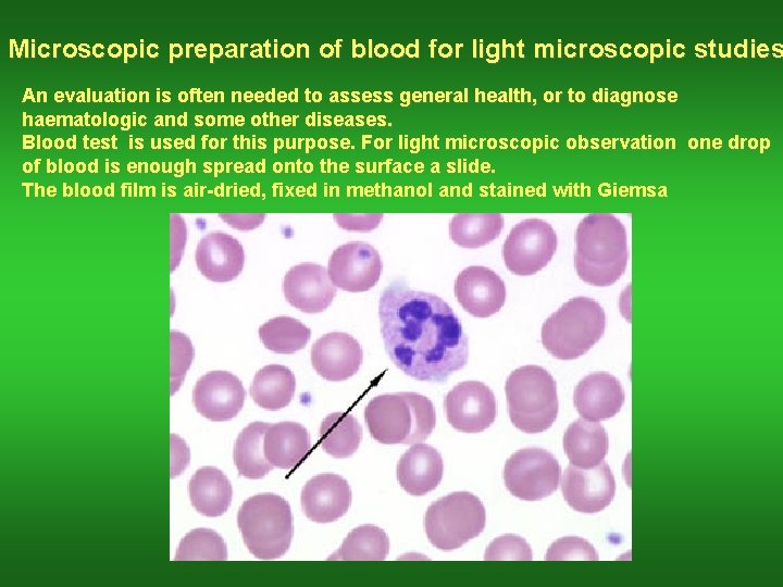 Microscopic preparation of blood for light microscopic studies An evaluation is often needed to