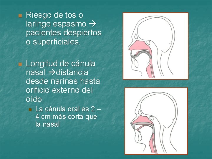 n Riesgo de tos o laringo espasmo pacientes despiertos o superficiales. n Longitud de