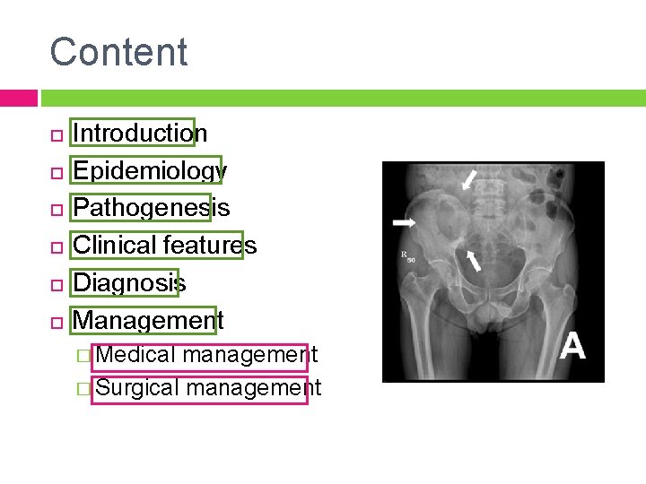 Content Introduction Epidemiology Pathogenesis Clinical features Diagnosis Management � Medical management � Surgical management