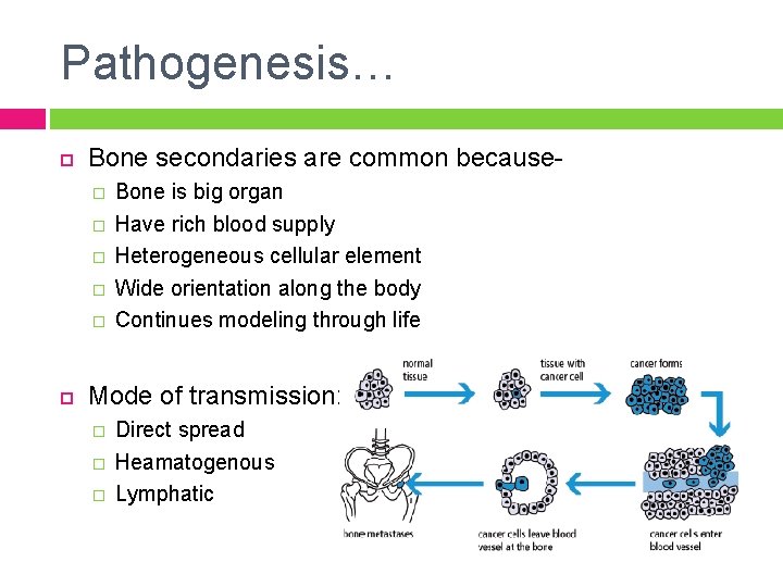 Pathogenesis… Bone secondaries are common because� � � Bone is big organ Have rich