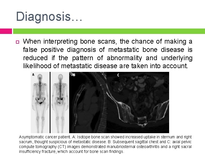 Diagnosis… When interpreting bone scans, the chance of making a false positive diagnosis of